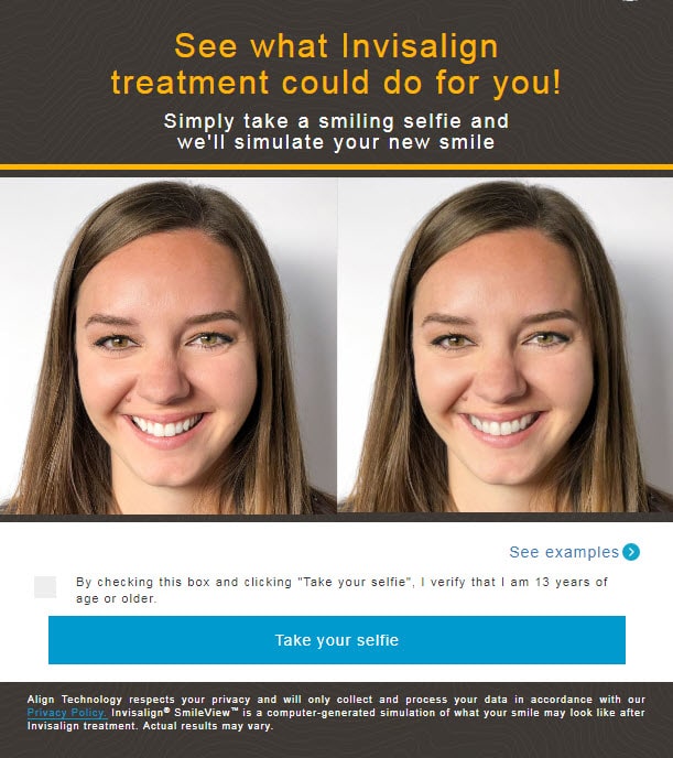 SmileView Invisalign 